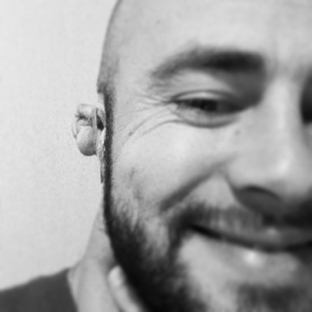Ear problem :(